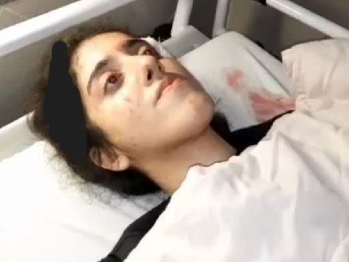 پلیس کشته شدن دختر ۲۰ ساله در پیاده راه فرهنگی رشت را تکذیب کرد